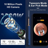 iHear - ZEUS XI - Wireless Otoscope